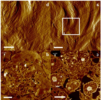Easy ultrastructural insight into the internal morphology of biological specimens by Atomic Force Microscopy 